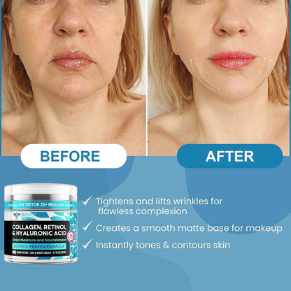 Ultimate SEAGRlL™Anti-Aging Cream (eliminates wrinkles in 2 minute)