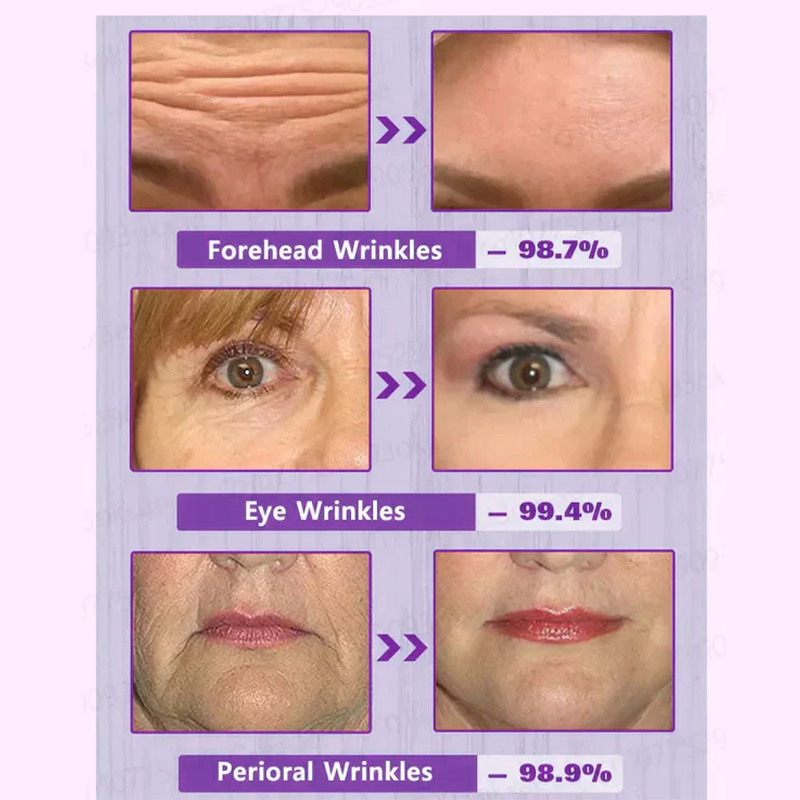 SEAGRIL-PEPTIDE  Wrinkle Reducing Cream contains 12 different peptides (eliminates wrinkles in 2 minute)